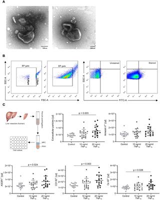 Sensing Acute Cellular Rejection in Liver Transplant Patients Using Liver-Derived Extracellular Particles: A Prospective, Observational Study